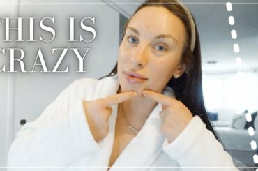 PIMPLE POPPING, EXPERIENCING LOSS, VEGAN CHILLI RECIPE !