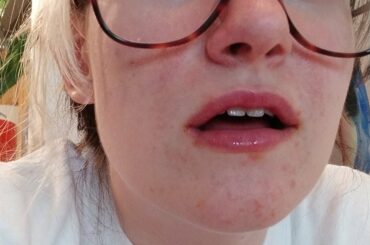 I'm not good with spicy food so I plan to eat Korean fire noodles every day until they're not mouth burning to me anymore. It is day one. Please enjoy my suffering.