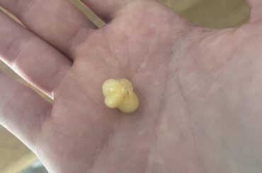 What is this?