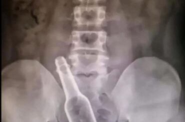 Petition to make this the new profile pic for r/spicy?