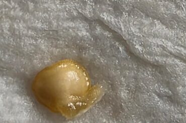 Growing white ghost peppers for the first time does this look like any of them are germinating