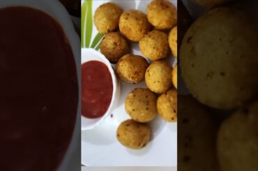 Amazing Potato Recipes ! French Fries ! Crispy Potatoes ! Potato Snacks#shorts