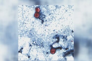 Health care providers warn of severe stomach bug illness in Illinois