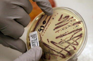Alfalfa Sprout Linked to Food-Poisoning Outbreak in 15 States, Health Officials Say