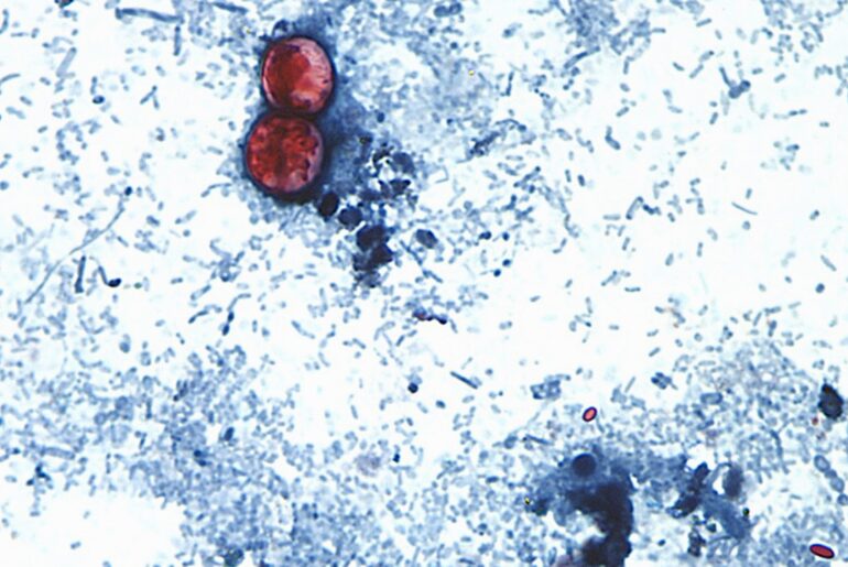 Cyclospora found at Mexican farmed linked to lettuce outbreak, FDA says – WTOP News